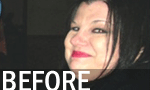 Before HCG Diet
