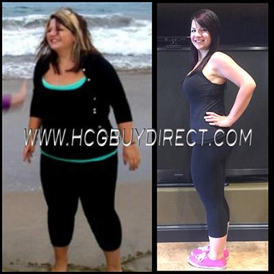HCG Diet Drops Before & After